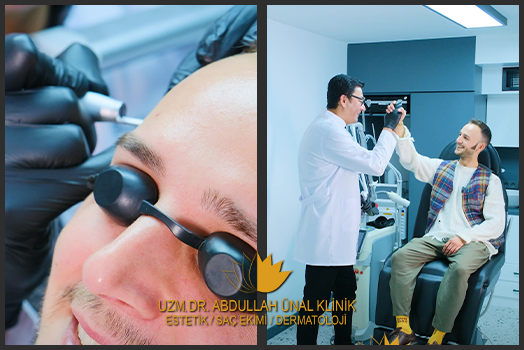 Comfortable mole removal with laser without pain, incision, suture and scar.