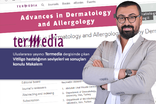 Our Scientific Article Published on Vitiligo is in International Termedia Magazine!