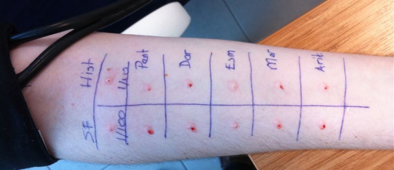 Allergic Skin Diseases and Allergy Tests