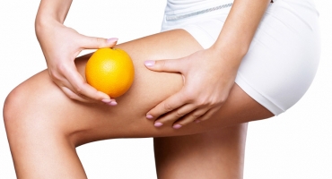 Cellulite Mesotherapy